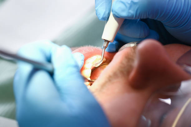 Best Emergency Dentist for Knocked-Out Tooth in Bottineau, ND
