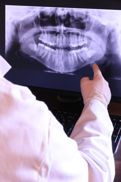 Best Emergency Dentist for Lost Fillings or Crowns in Bottineau, ND