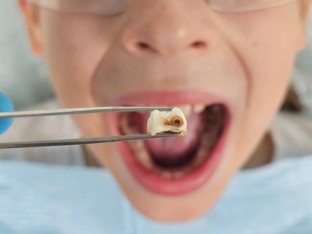 Best Urgent Dental Care for Toothache in Bottineau, ND