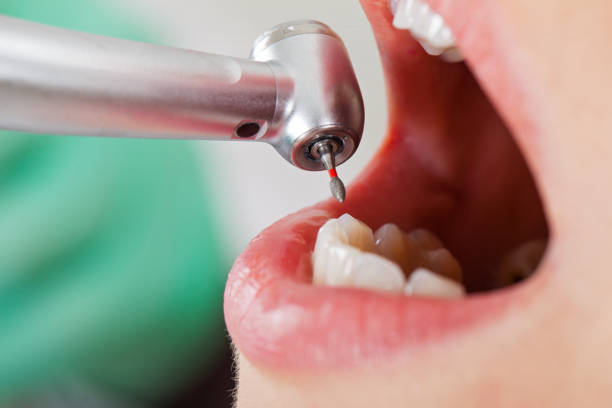 Best Emergency Dental Extractions in Bottineau, ND